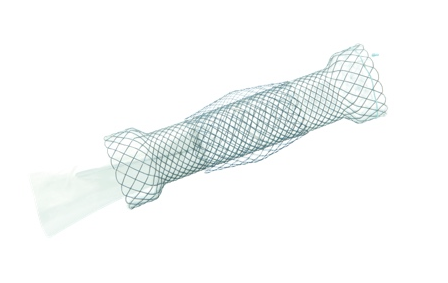 Niti-S™ Esophageal Double Anti Reflux Stent