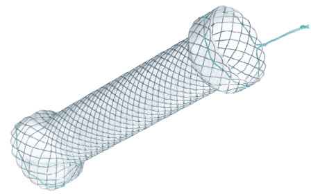 Niti-S Biliary Interventional Ureter Stent