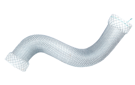 Niti-S™ Esophageal Mega Stent