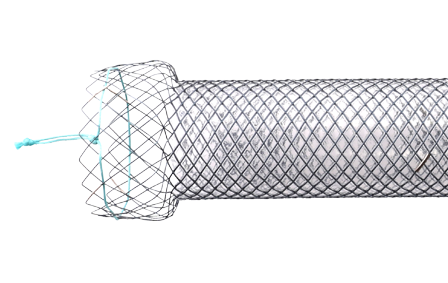 Niti-S Pyloric/duodenal D-Type™ Radiology