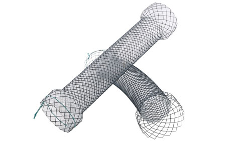 Niti-S Pyloric/duodenal D-Type™ Uncovered Stent
