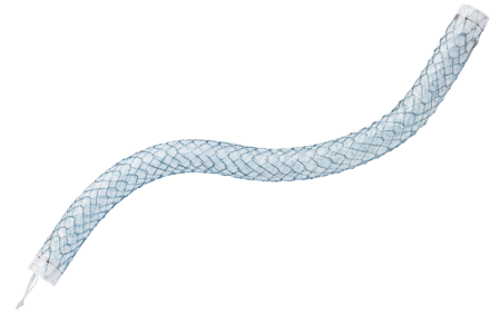 Niti-S Biliary Interventional Ureter Stent